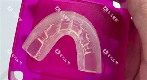 罗慕儿牙矫治器