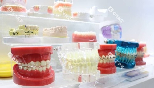 合肥佳德口腔假牙示意图 合肥佳德口腔假牙示意图