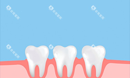 牙齿动画展示图