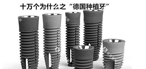 德国种植牙示意图