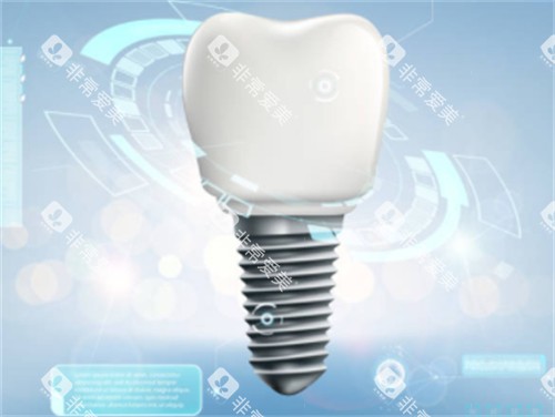 种植牙背景图