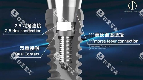 韩一种植牙材料展示照片