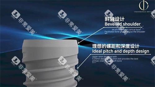 韩一植体优势有哪些