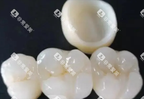 全瓷牙展示 全瓷牙展示