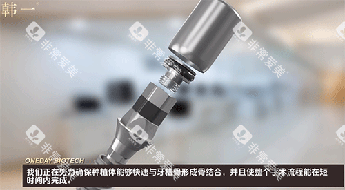 韩一种植体示意图