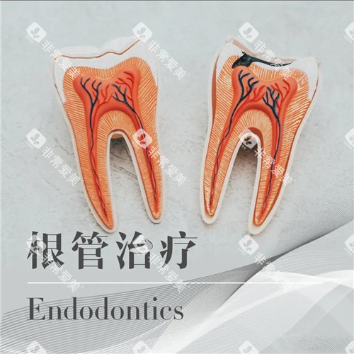 根管治疗图示
