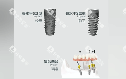 安联种植牙用起来怎么样 安联种植牙用起来怎么样