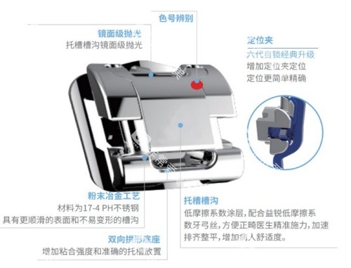 益锐UDG金属自锁托槽6.1代托槽细节优势图 益锐UDG金属自锁托槽6.1代托槽细节优势图