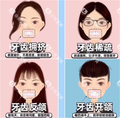 牙齿矫正自查表 牙齿矫正自查表