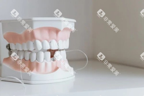 残缺的牙齿展示