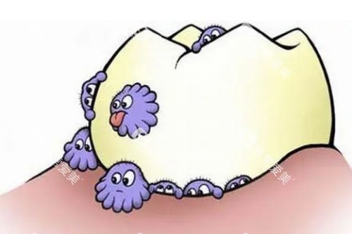 牙齿有细菌卡通展示图