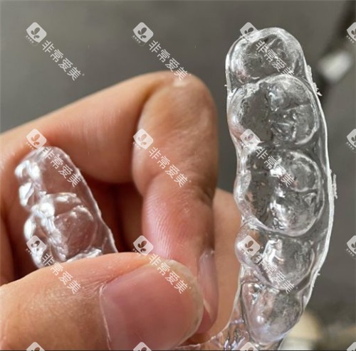 正雅隐形牙套