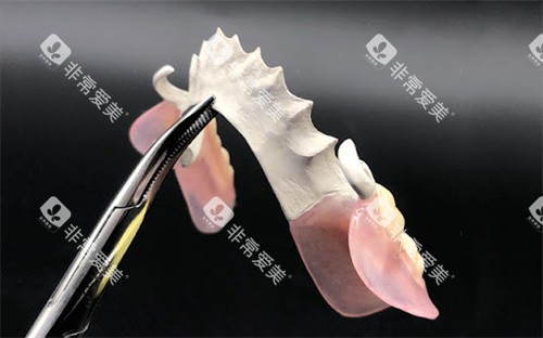 PROHPP支架成品