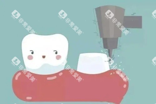 牙齿打桩卡通图