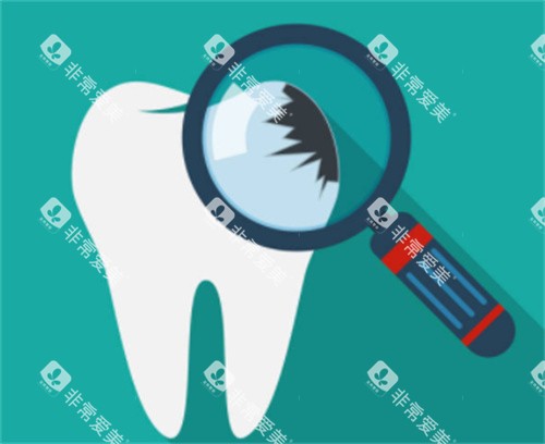 牙齿检查图