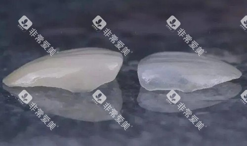 瓷贴面修复对比