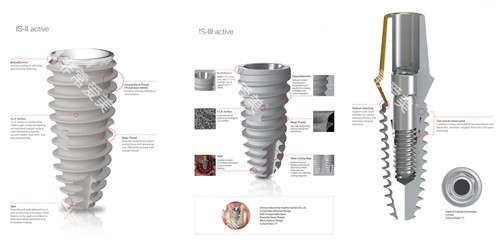 韩国纽百特种植牙植体设计