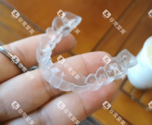 隐形牙齿矫正牙套图