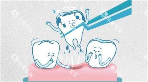 牙齿拔除卡通示意图