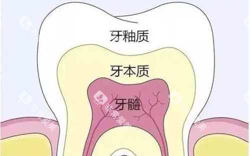 牙齿不同层次卡通示意图