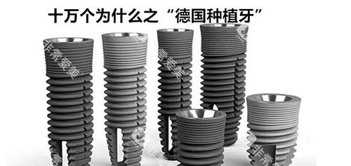 德国种植牙示意图