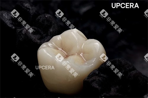 瓷倍健全瓷牙