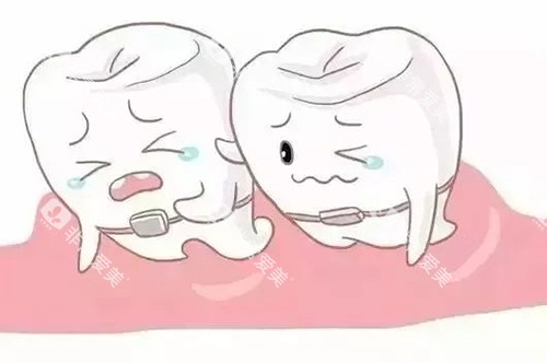 牙齿矫正卡通 牙齿矫正卡通