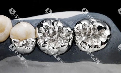 烤瓷牙素材图片