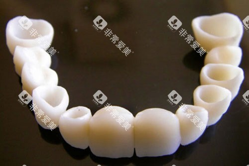 半口全瓷牙冠示意图