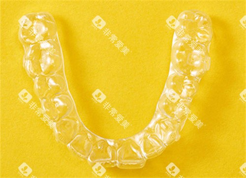 丽绮美隐形矫正实物图 丽绮美隐形矫正实物图