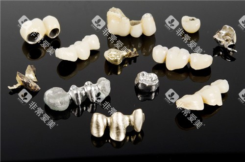 烤瓷牙素材种类