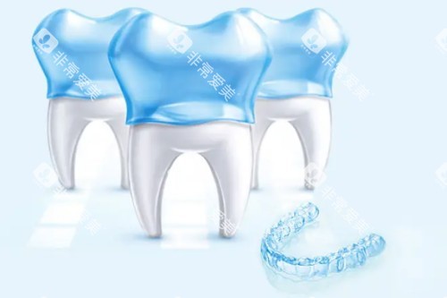 隐形矫正器卡通图 隐形矫正器卡通图