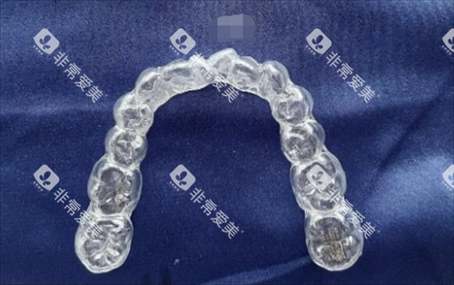 时代天使隐形矫正器 时代天使隐形矫正器