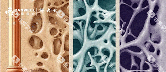科惠种植牙骨密度检测