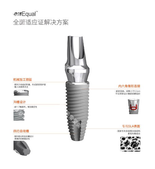 百齿泰DMEqual种植体优势介绍图