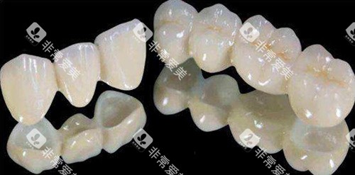 全瓷牙冠示意图