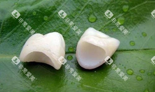 全瓷牙冠照片实物图