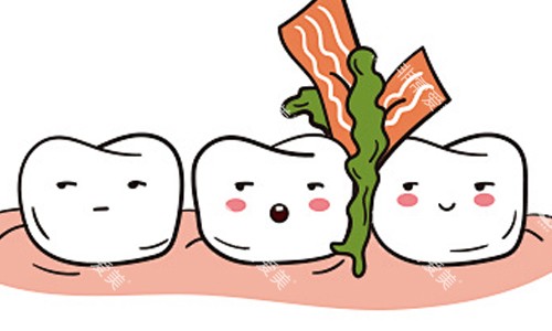 食物残留导致龋齿展示