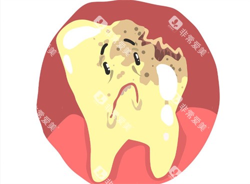 龋齿卡通