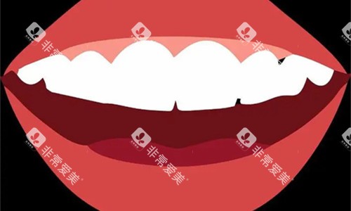 牙齿整齐卡通图