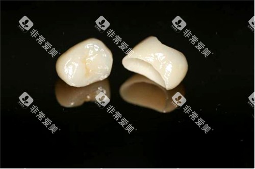 两颗全瓷牙冠实物图