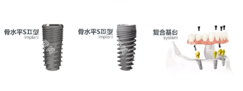 安联种植牙型号