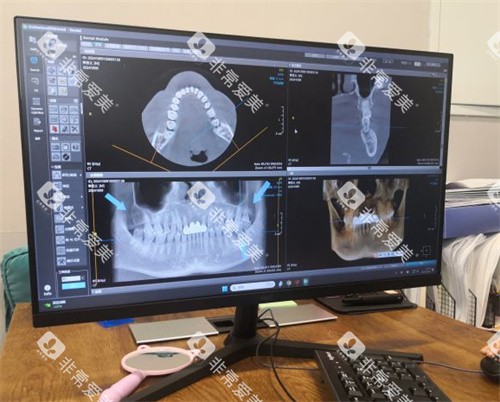 北京牙元素口腔牙齿拍片室 北京牙元素口腔牙齿拍片室