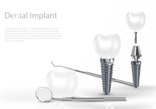 种植牙和器具示意图