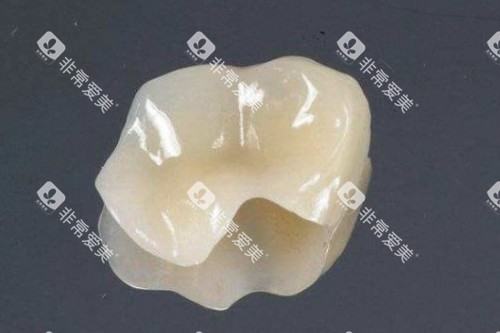 补牙材料卡通图 补牙材料卡通图