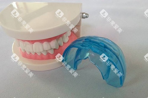 MRC功能性矫治器示意图 MRC功能性矫治器示意图