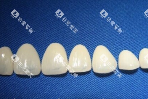 牙冠卡通模型图 牙冠卡通模型图