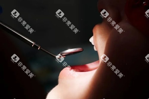 牙齿检查展示图