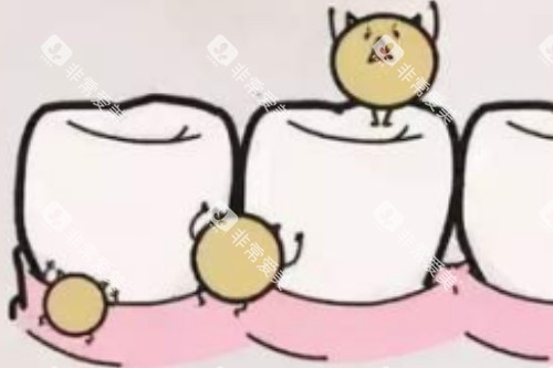 牙齿有细菌卡通图 牙齿有细菌卡通图