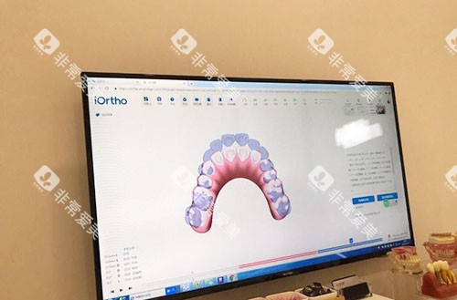 温州爱牙故事口腔牙齿矫正方案设计 温州爱牙故事口腔牙齿矫正方案设计